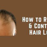20 Best Hair Loss Treatments